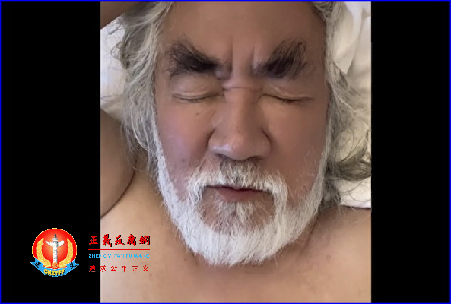 著名导演张纪中在社交平台上曝出自己感染病毒。.png 著名导演张纪中在社交平台上曝出自己感染病毒。.png