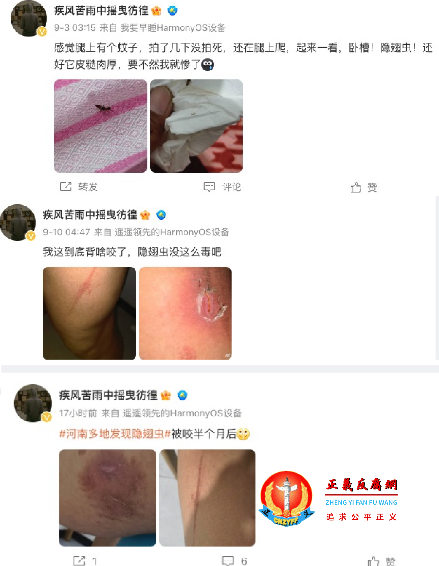 2023年9月,河南网民透露自己被隐翅虫叮咬后的状况。.png 2023年9月,河南网民透露自己被隐翅虫叮咬后的状况。.png