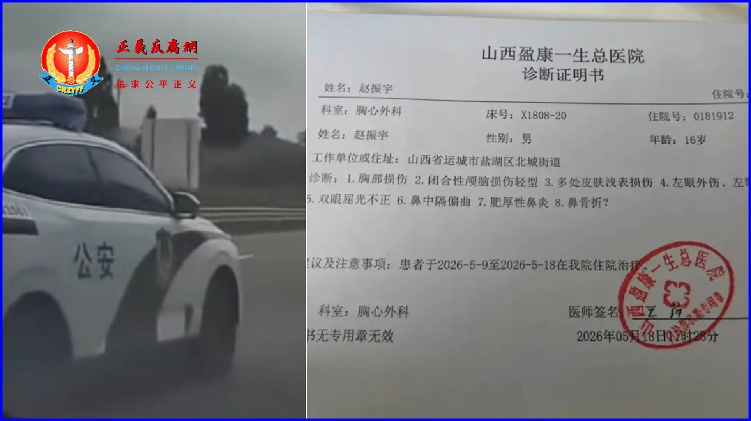 山西一16岁男生被同校校友在家门口殴打致伤，报警后，肇事者邀假警察将受害人骗出再次进行殴打。赵先生提供儿子被殴打受伤一份2026年5月8日，山西盈康一生总医院出具的诊断证明书。.jpg